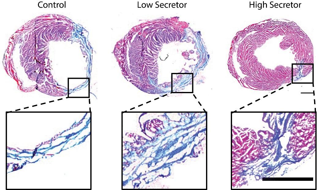 In a lab model, heart tissue treated with high-secreting stem cells (right) showed more regeneration than heart tissue treated with low-secreting cells (middle) or receiving no treatment (left).