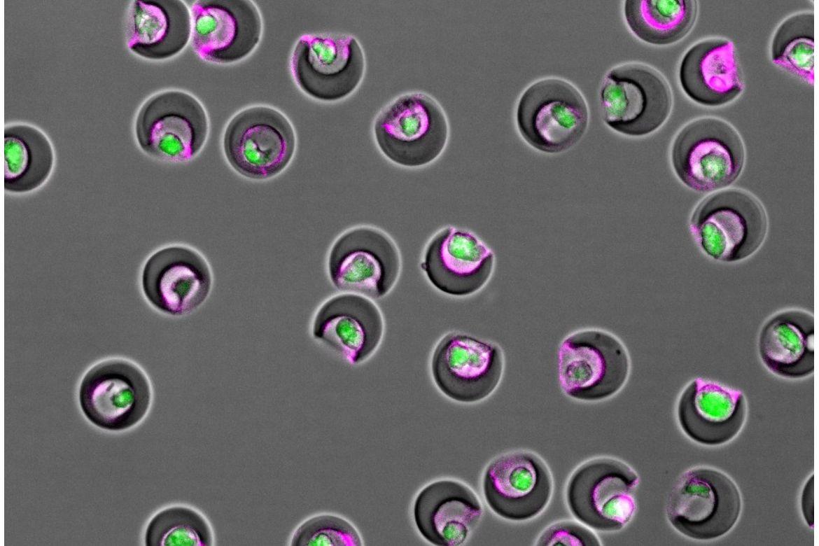 Nanovials containing individual cells (green) and secreted extracellular vesicles (magenta) within their cavities.
