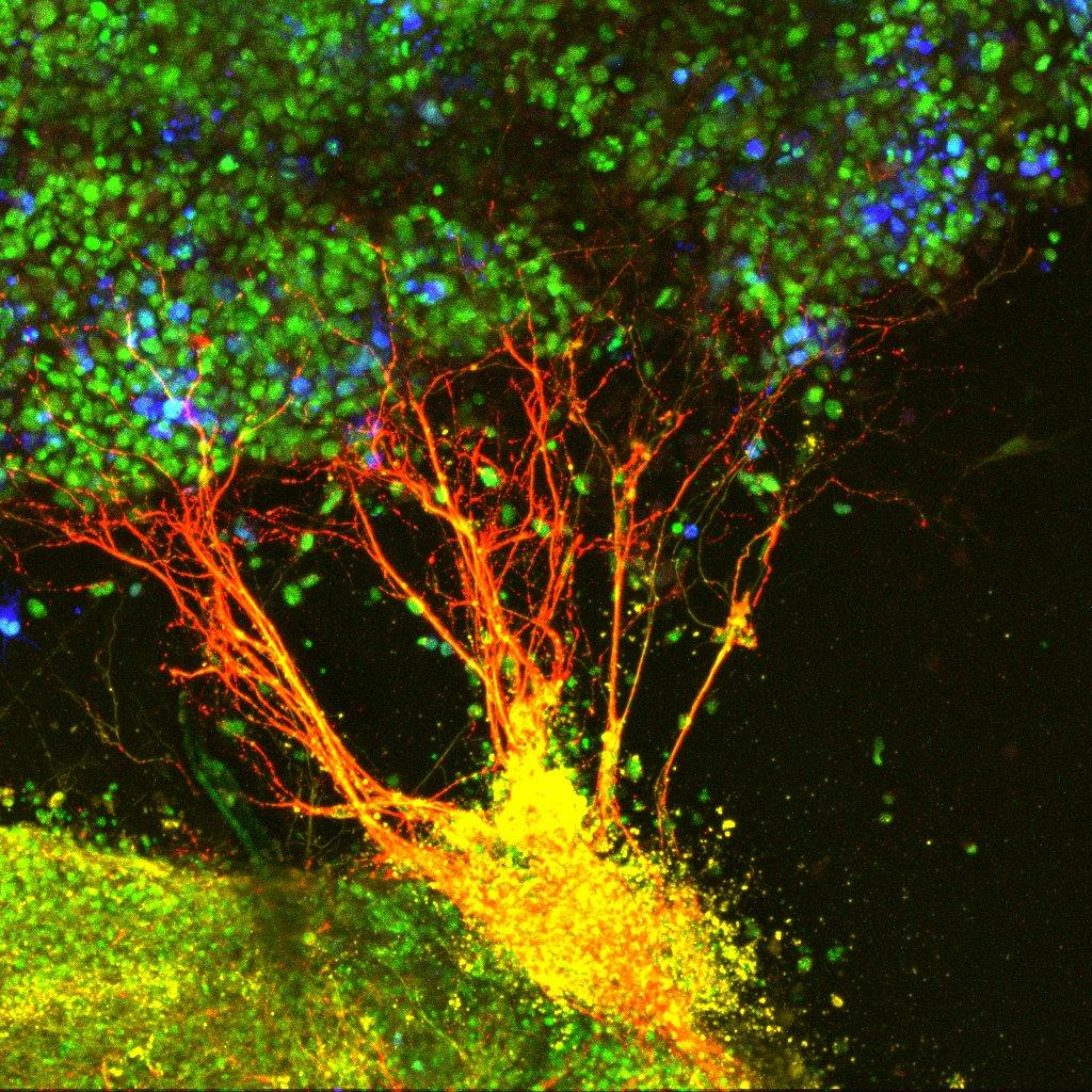 This image shows a bundle of dorsal interneurons from the rat embryonic spinal cord (red and yellow) growing towards an aggregate of cells expressing the green fluorescent protein (blue with nuclei labeled green).