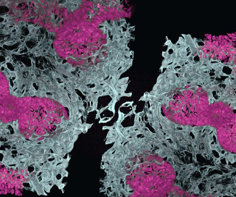 Microscopy image of embryonic mouse lung showing blood vessels (white) and air sacs (pink)