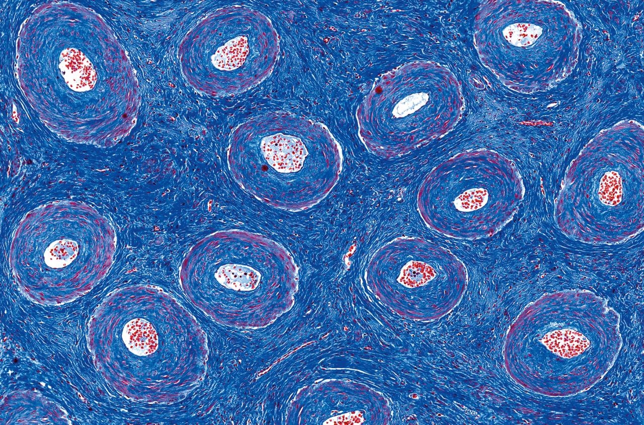Laboratory image of a stained human ovary highlights the intricate network of blood vessels interwoven with structures of connective tissue.