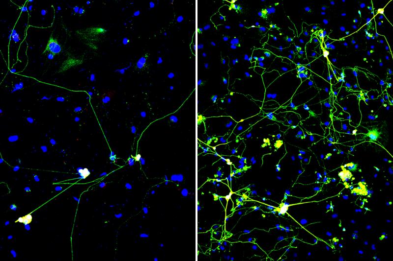 Two fluorescence microscopy panels of cells with blue nuclei and green neuron-like cells. The left panel shows only a few sparse neurons with long, thin projections, while the right panel shows many more neurons with dense, branching networks.