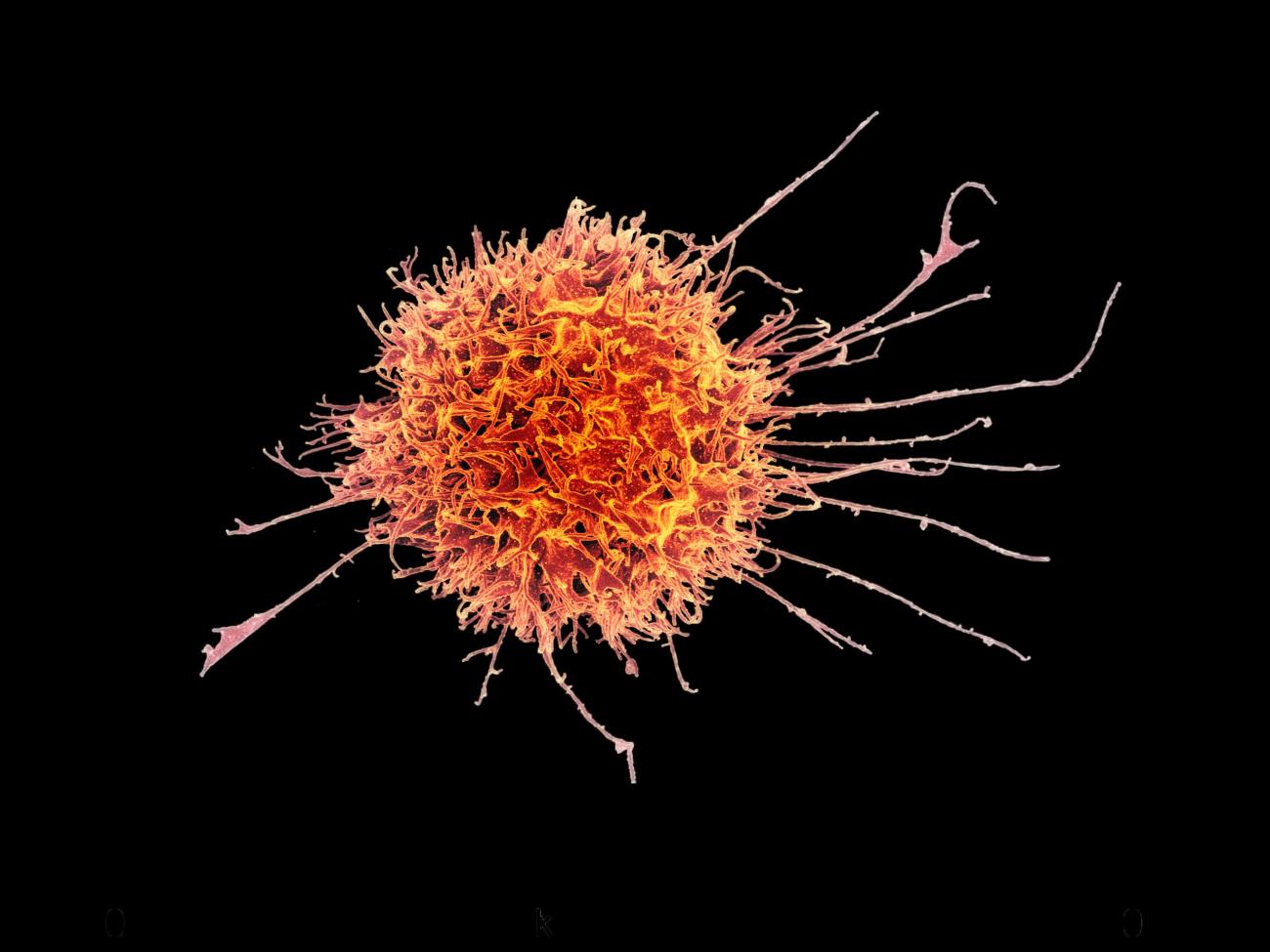 A microscopy image of a human immune cell taken by NIH scientists.