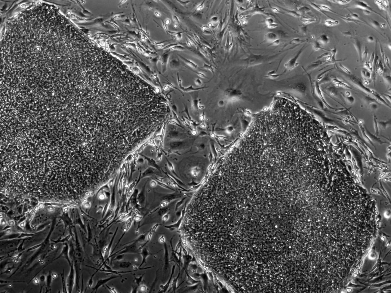 Microscopy image of iPSCs.