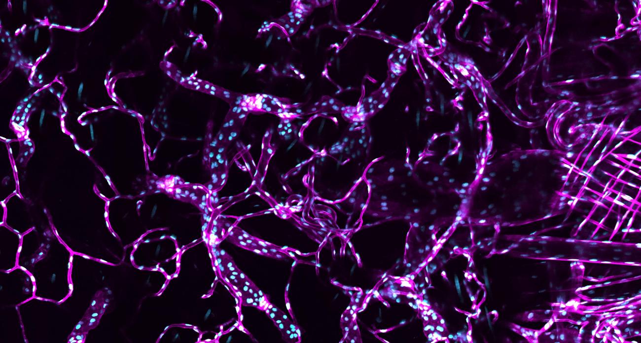 A genetic reporter of endothelial membranes and nuclei allowing for visualization of vascular network architecture and cellular dynamics. (Credit: Kam Lab)