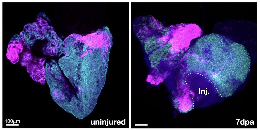 An uninjured (left) and injured adult zebrafish heart with the specific population of cells that responds to injury labeled magenta. These cells are activated around the edge of the injury (right) in preparation for regenerating the heart muscle. 