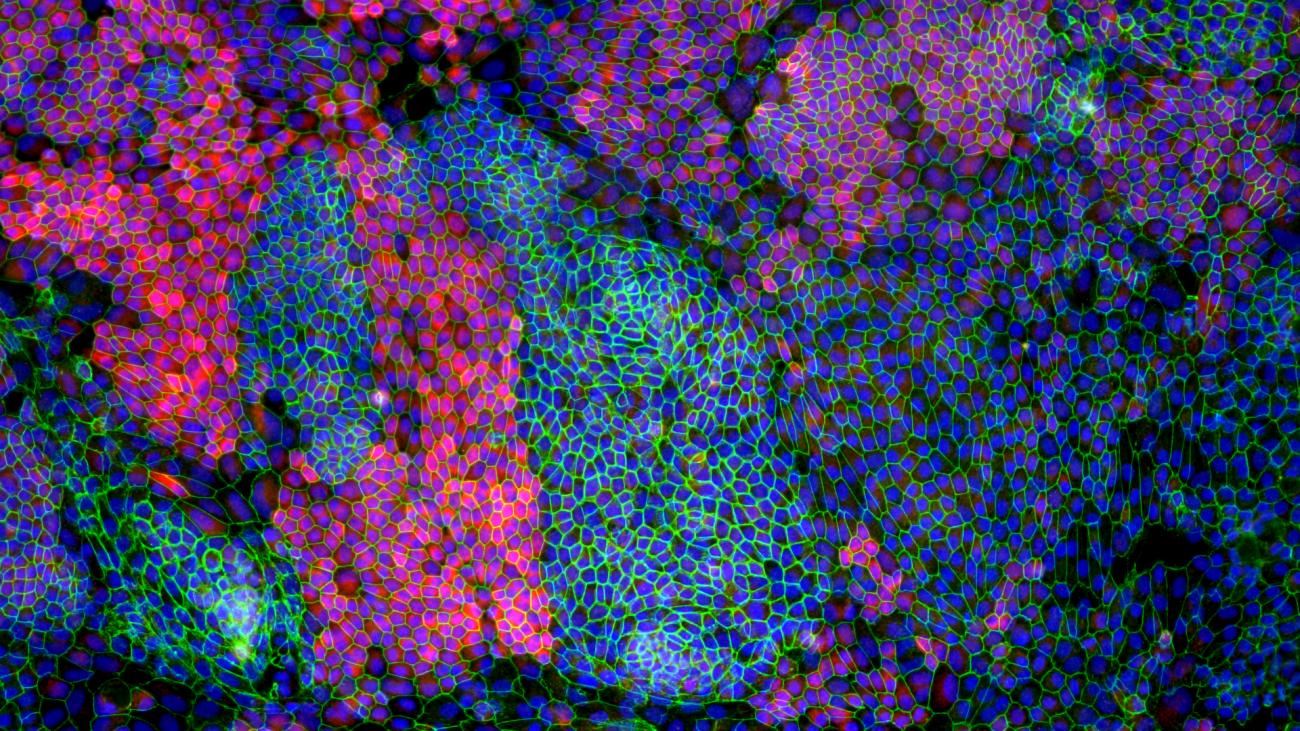 Colorful microscopy image of retinal pigment epithelium derived from an induced-pluripotent stem cell line.