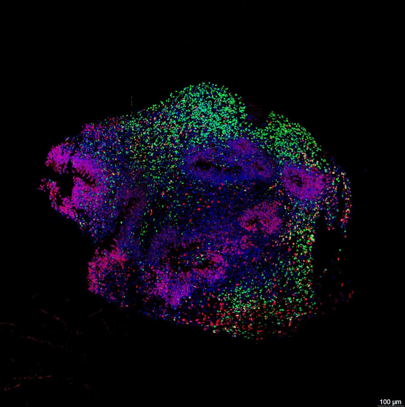 Representative image of a developing human cortex-like organoid. 