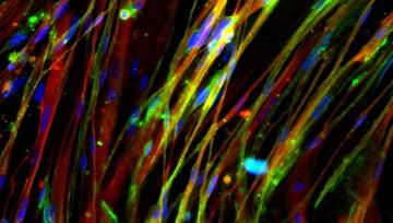 Vibrant cell microscopy image of bone muscle 