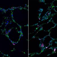 3-D bioengineered lung-like tissue (left) resembles adult human lung (right).