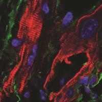 Immunofluorescent staining demonstrating fibroblasts expressing the Channelrhodopsin protein in heart scar tissue. The ChR2-expressing fibroblast (green) is in close proximity to cardiomyocytes (red) within scar.