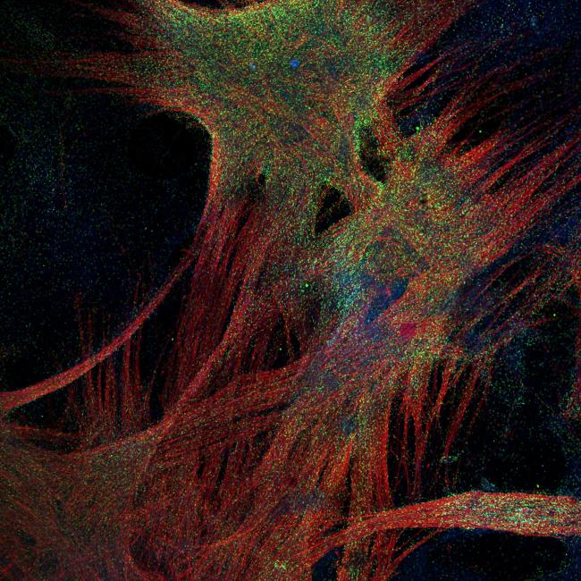 Microscopic image of skeletal muscle fibers (in red) produced from embryonic stem cells. The muscle stem cell (in green) will be use in cell therapy to regenerate human skeletal muscles. The nuclei of the cell is shown in blue.