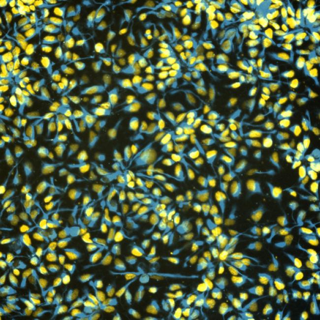 Fluorescence microscopy image of human stem cell-derived neural progenitor cells in a cell village.