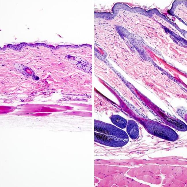 Untreated mouse skin showing no hair growth (left) compared to mouse skin treated with the drug UK5099 (right) showing hair growth. Credit: UCLA Broad Stem Cell Center/Nature Cell Biology