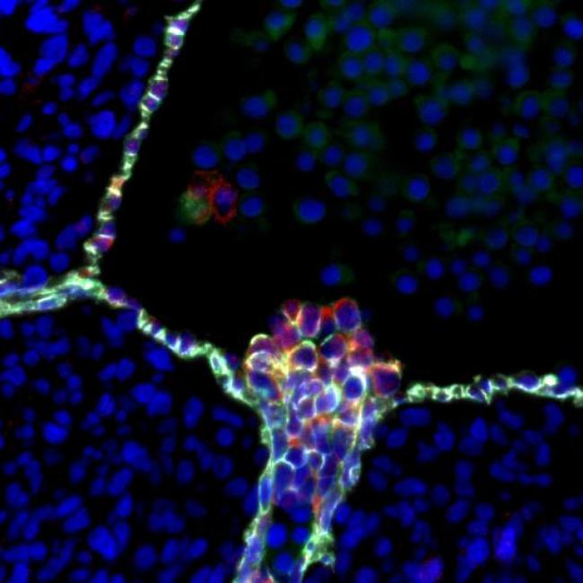 Human blood stem cells emerging from specialized endothelial cells in the wall of an embryonic aorta.