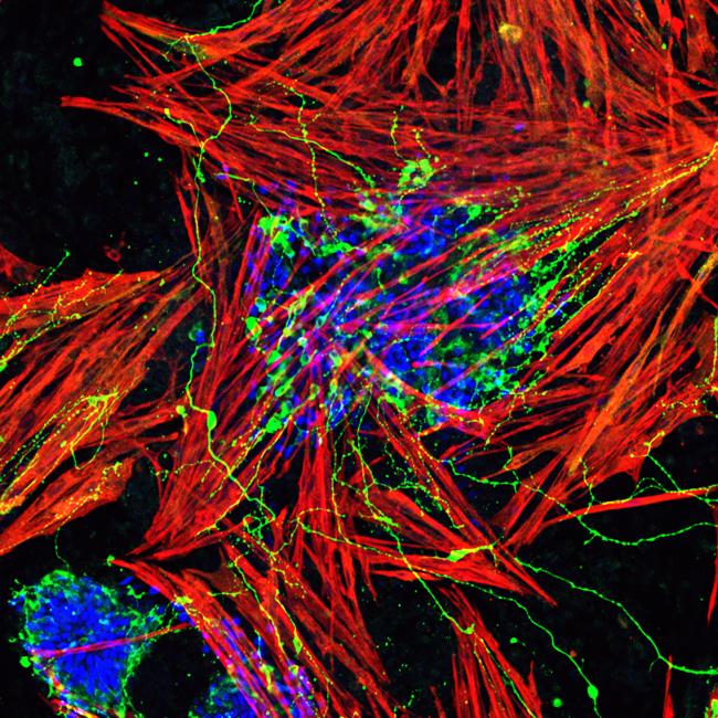 This image depicts the simultaneous differentiation of muscles and motor neurons from the mouse embryonic stem cell-derived NMPs. The cultures were fixed and stained with neurons and muscle-specific antibodies. Motor neurons are labeled with a neuronal marker-Tuj1 (in green).