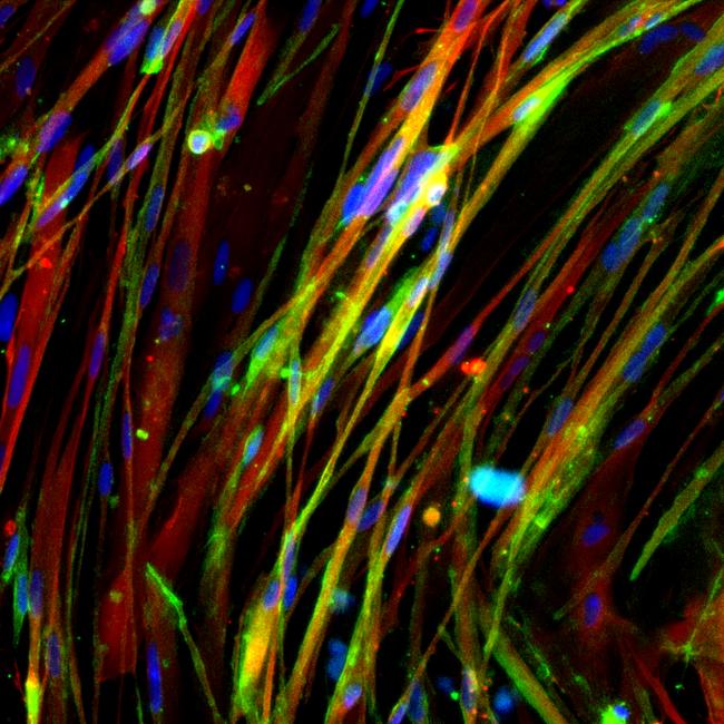 A microscopy image demonstrating restoration of beta dystroglycan in muscle myotubes derived from CRISPR/Cas9 corrected DMD human induced pluripotent stem cells.