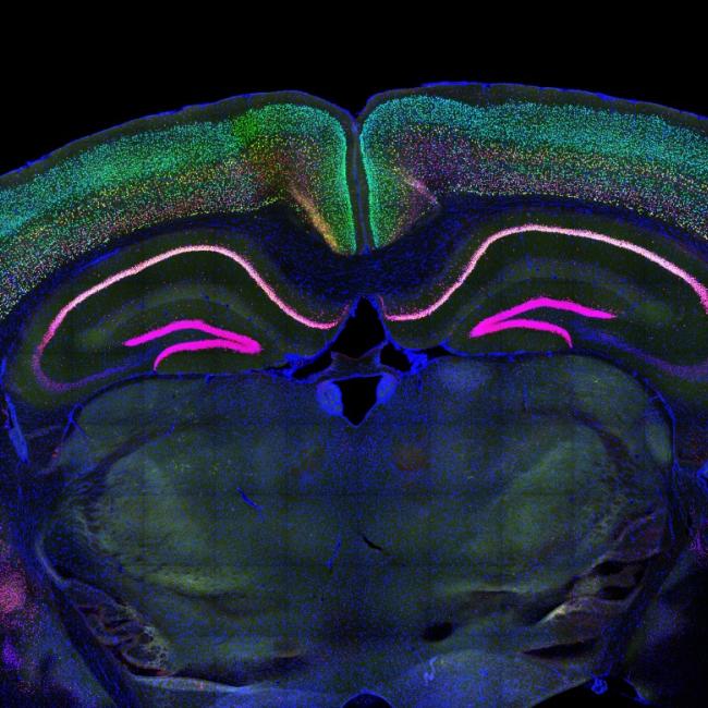 microscopy image of a mouse brain