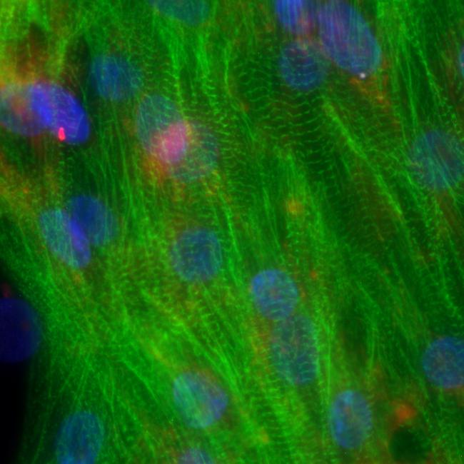 Fluorescent green striated muscle fibers with large blue and pink nuclei.