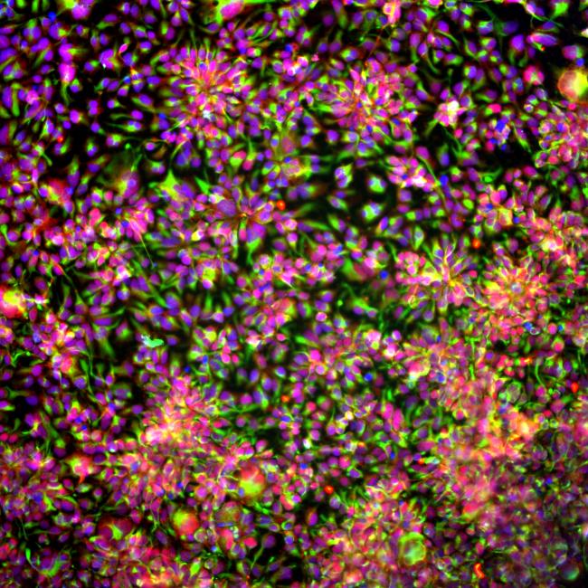 Dense fluorescent cell culture with pink nuclei and green connections.