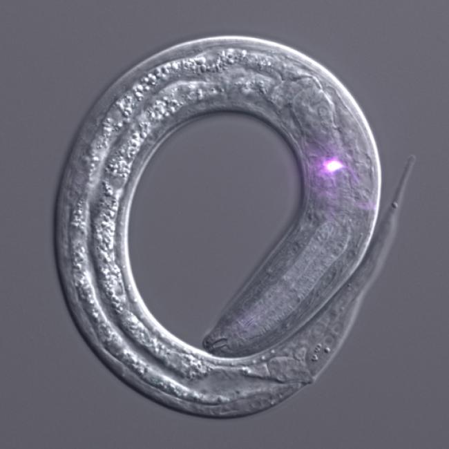 A human-parasitic larva with its neurons shown in white