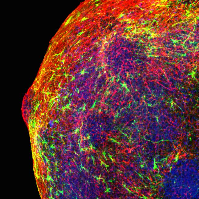 Fluorescence microscopy of a cortical spheroid showing a dense, rounded tissue structure composed of an intricate, tangled web of red and green fibrous networks over a deep blue background.