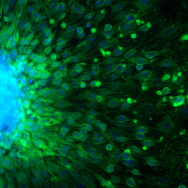 Microscopic image of a embryoid body formed by induced pluripotent stem cells, showing their nuclei (blue) and VE-cadherin (an endothelial cell marker, green).