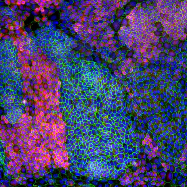 This image captures a retinal pigment epithelium, or RPE, derived from an induced-pluripotent stem cell, or iPSC, line. Image shows cell borders (green), mature RPE-specific marker (red), and cell nuclei (blue) in iPSC-RPE cells in order to confirm the identity of iPSC-derived RPE cells.