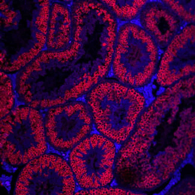 Fluorescent red cross-sections of tubular structures on a blue background.