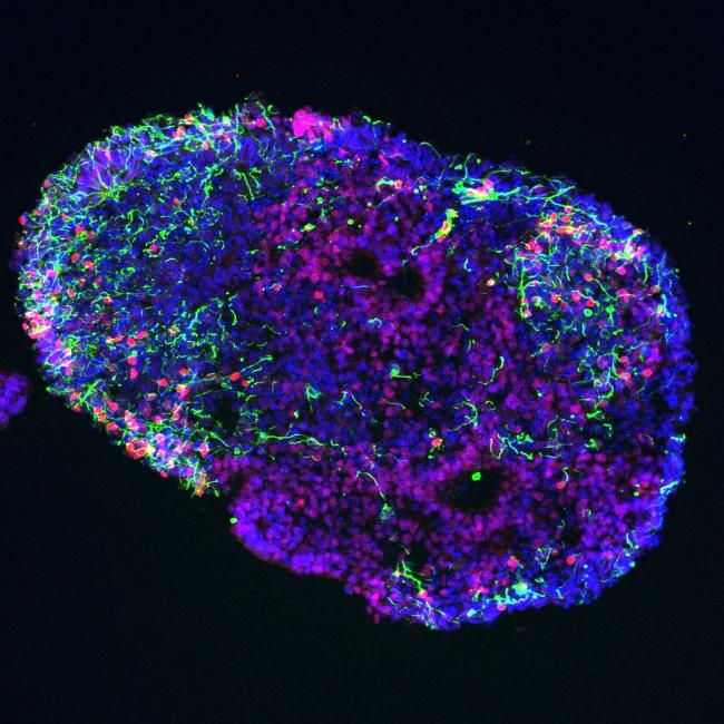 Microscopy image shows some of these nerve cells, called dI3 neurons (shown in red and green staining), in the 30-day-old 3D spheroid (shown in blue).