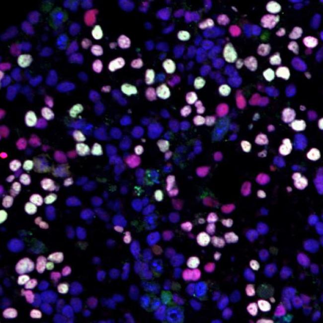 Differentiating human pluripotent stem cells (blue) turning into human germ cells (pink and white).