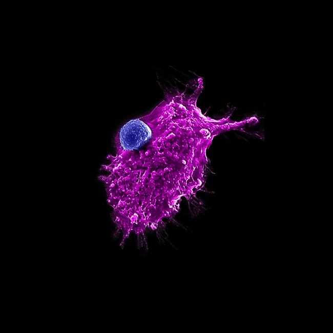 High-magnification microscopy showing a large, highly textured magenta cell with a smaller, round, blue cell attached directly to its surface against a solid black background.