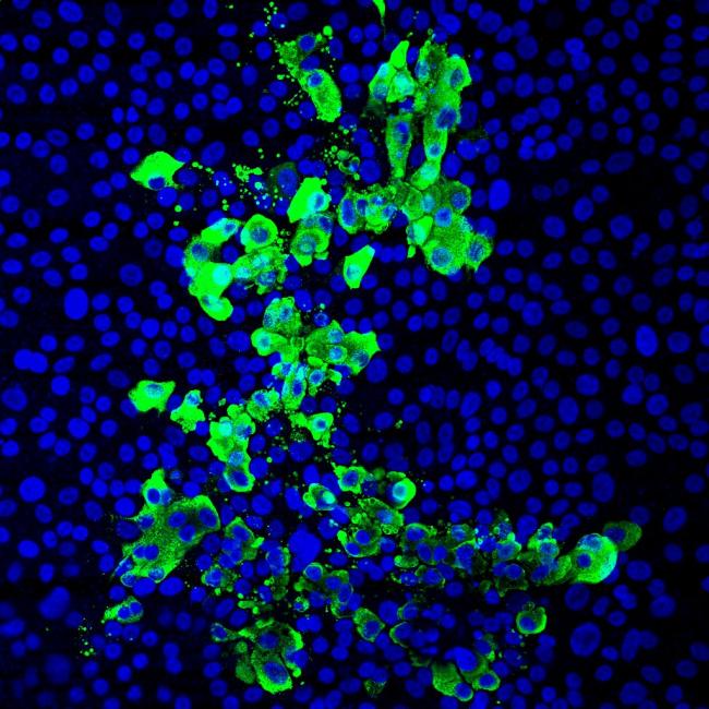 Microscopic images of human stem cell–derived airway tissue models with cell nuclei (blue) and SARS-CoV-2 virus infected cells (green); tissue exposed to cigarette smoke had 2 to 3 times more infected cells than non-exposed tissue.