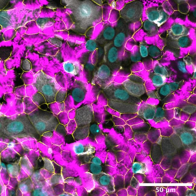 Microscopic image of airway epithelium, showing stem cells (in white) that regenerate and mature into differentiated cells of the airway, including ciliated cells (in fuchsia) to form an impermeable barrier with tight junctions between cells (in green).