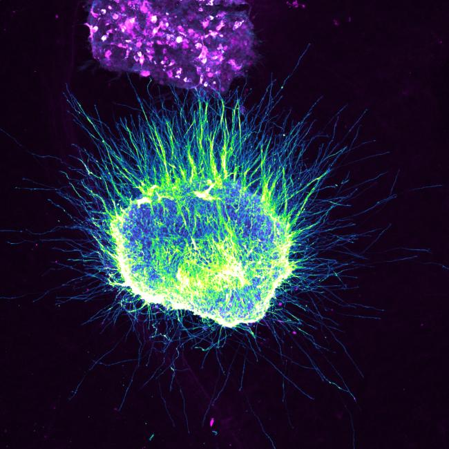 Fluorescence microscopy of a neuron showing a bright green and blue cell body with a dense, radiating network of fine processes.