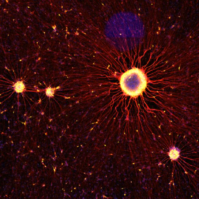 Fluorescence microscopy of neural cells with glowing yellow centers and extensive red, star-like branching processes on a dark background.