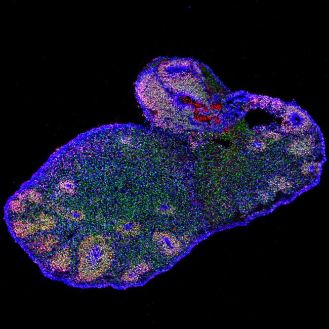 Microscopic image of a brain organoid that looks like a bunny. 