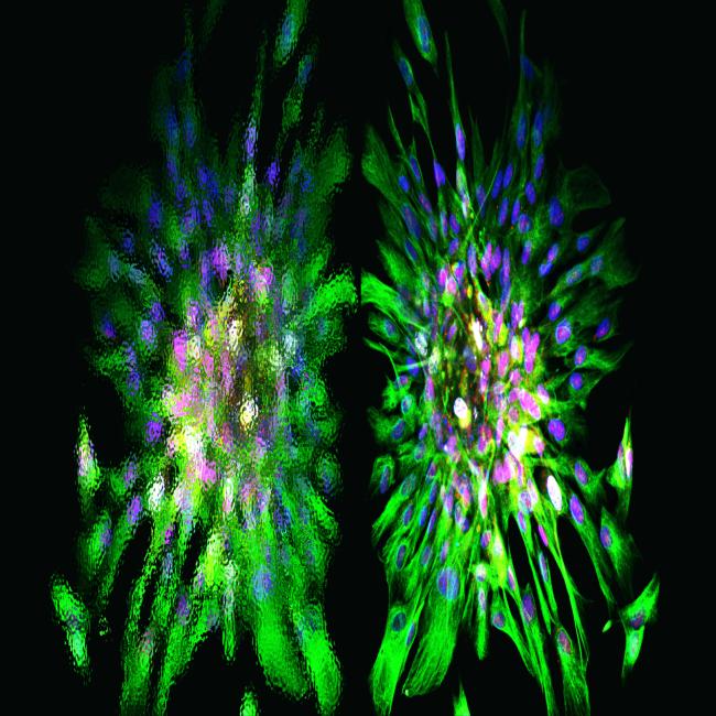 Fluorescence microscopy of tissue showing two large, starburst-like cellular structures with outward-radiating green streaks and dense clusters of pink and blue nuclei at their centers.