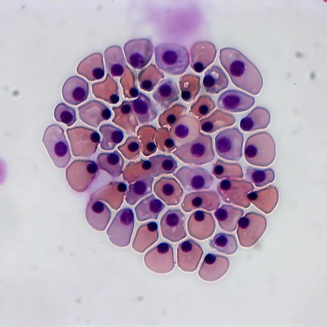 Microscopy of a tight cluster of light pinkish-purple cells, each containing a distinct dark purple nucleus, set against a pale background.