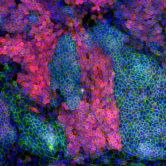 Fluorescence microscopy of epithelial cells forming a dense, cobblestone-like pattern with bright green borders and pink and blue interiors.