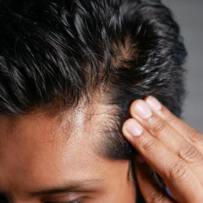 Close-up of a person touching their temple area while looking down, showing their hairline and dark hair