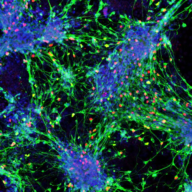 Fluorescence microscopy of sensory interneurons forming a web of interconnected green processes, dotted with distinct pink and blue cell bodies.