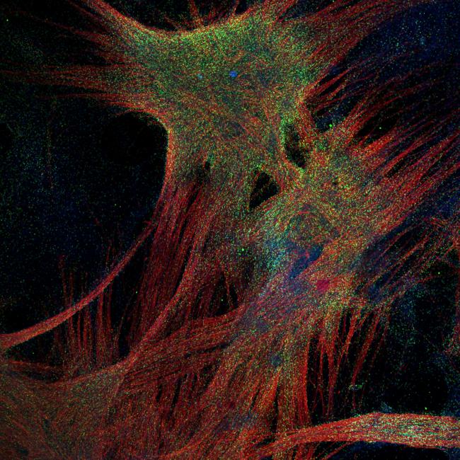 Fluorescence microscopy of skeletal muscle showing thick, overlapping bundles of red fibers interspersed with green speckles.