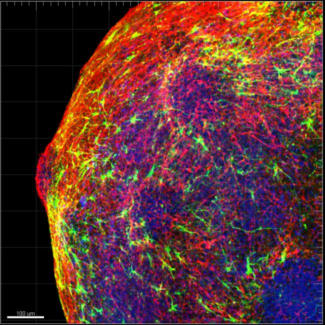 A microscopy image of human stem-cell derived neurons made to form a human cortical sphreoid.