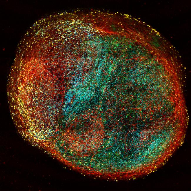 A slice through an organoid of the developing human cortex, labeled for different brain cell types: oligodendrocytes in green, astrocytes in yellow, and neurons in red. 