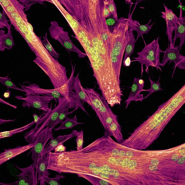 Microscopic image of muscle cells fusing to form proto-muscle structures (myotubes) with the cytoskeletal structures (coral) and nuclei (green) visible