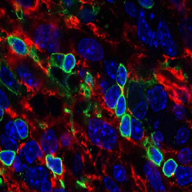 A section of an artificial thymic organoid showing T cells (outlined in green) created from blood stem cells. | UCLA Broad Stem Cell Research Center/Cell Reports