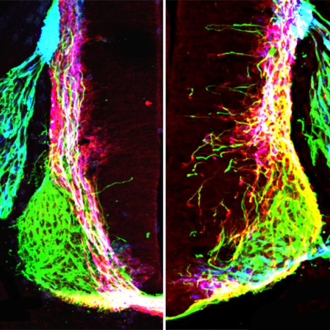 Left: axons (green, pink, blue) form organized patterns in the normal developing mouse spinal cord. Right: removing netrin1 results in highly disorganized axon growth.