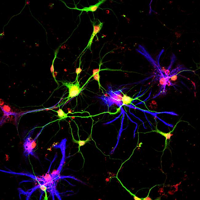 Neurons (in green) producing growth differentiation factor 10 (red), a molecule discovered by UCLA scientists that previously had no known role in the adult brain.