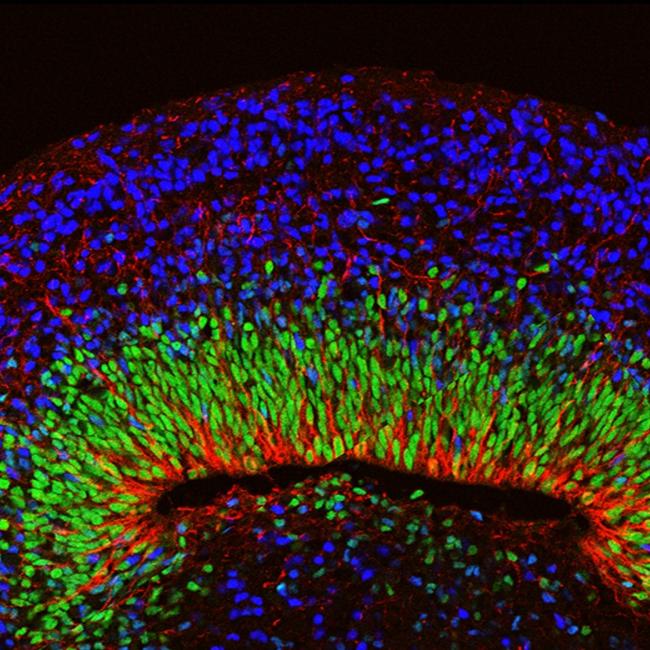 A microscope image of a mini brain organoid showing layered neural tissue and different types of neural cells.